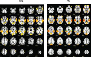 AFNI and FSL